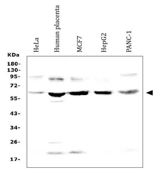 Anti-STS / Arylsulfatase C