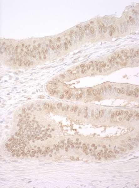 Anti-CNOT2 (IHC)
