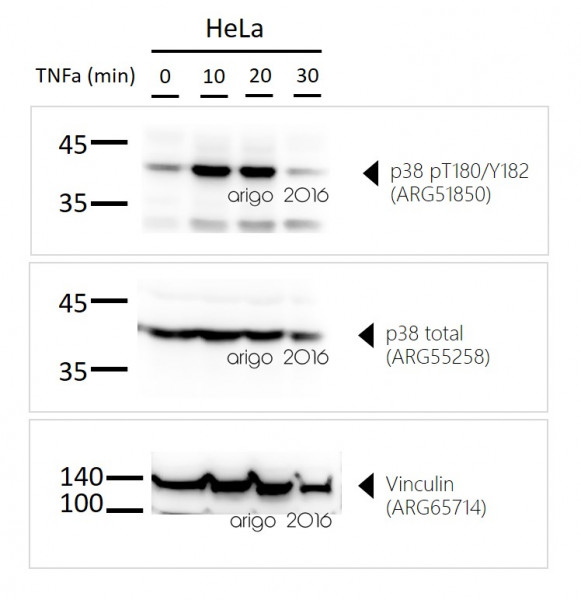 Anti-phospho-P38 MAPK (Thr180/Tyr182)