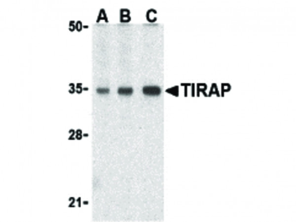 Anti-TIRAP (Toll-interleukin 1 receptor domain-containing adaptor protein)