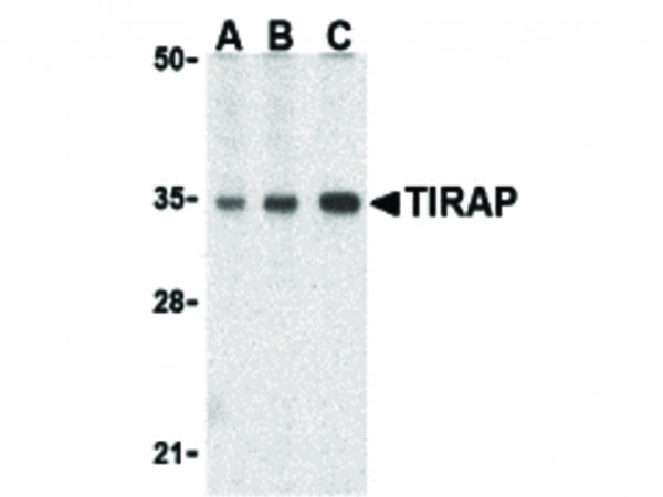 Anti-TIRAP (Toll-interleukin 1 receptor domain-containing adaptor protein)