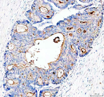 Anti-MUC13 / Mucin 13