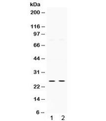 Anti-Thymidine kinase 1