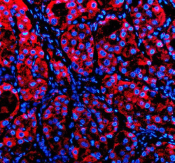 Anti-P4HA1 / Prolyl 4-hydroxylase subunit alpha 1
