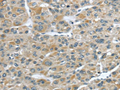Anti-CFAP45