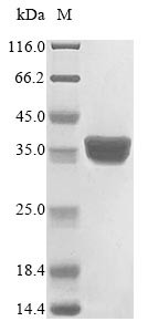 40S ribosomal protein S3 (RpS3), Drosophila melanogaster, recombinant