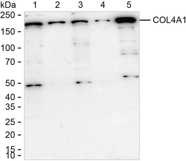 Anti-COL4A1
