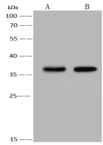 Anti-RANKL Monoclonal Recombinant Antibody