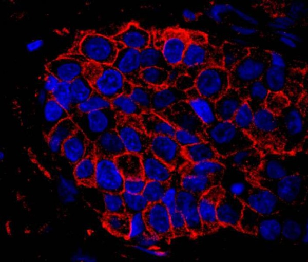 Anti-IQGAP1 (IHC)