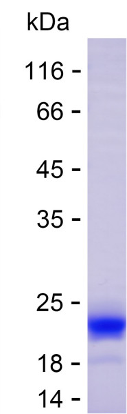 Recombinant Human FADS2 Protein