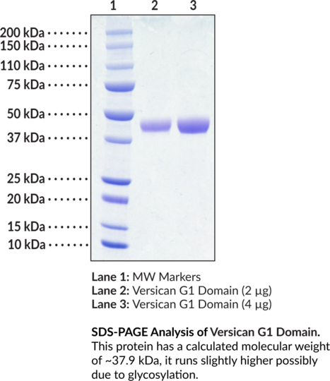 Versican G1 Domain (human, recombinant)