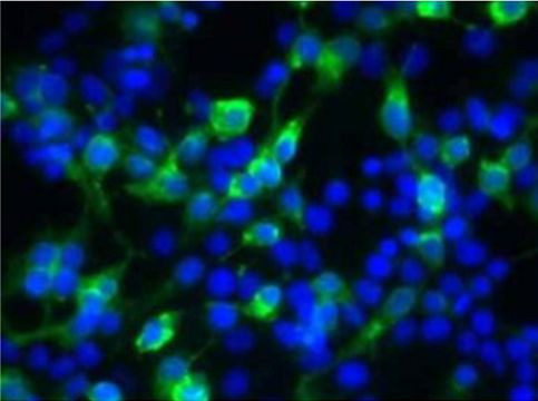 Anti-Bestrophin
