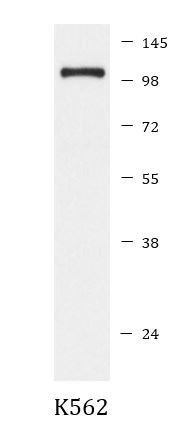 Anti-phospho-IRE1a (Ser724)