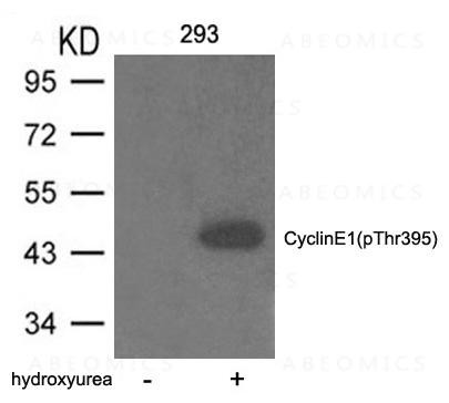 Anti-Cyclin E1 (phospho-Thr395)