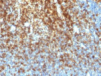 Anti-CD43 (T-Cell Marker) (clone: SPN/1766R) (recombinant rabbit monoclonal)