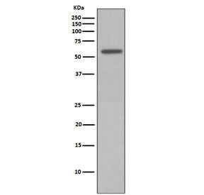 Anti-phospho-Vimentin (Ser72), clone ADE-22