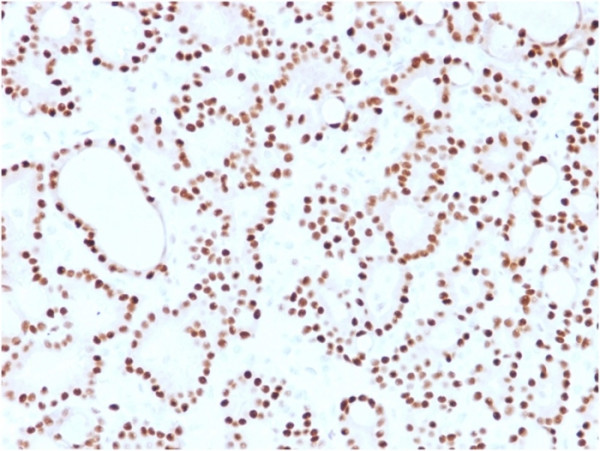 Anti-Cyclin D1 (G1-Cyclin &amp; Mantle Cell Lymphoma Marker), clone CCND1/2593