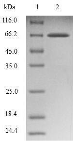 Endophilin-B1 (SH3GLB1), human, recombinant