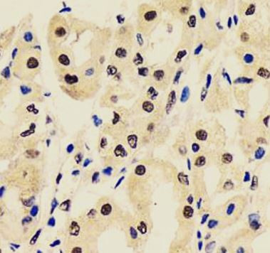 Anti-CBX1 / HP1 beta