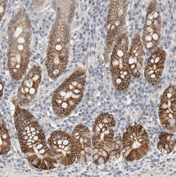 Anti-HCN3
