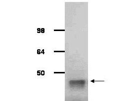 Anti-Aldolase (rabbit muscle)