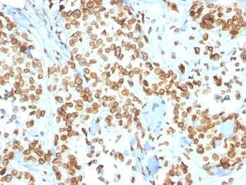 Anti-Emerin (Papillary Thyroid Carcinoma and EDMD Marker) Monoclonal Antibody (Clone: EMD/2167)
