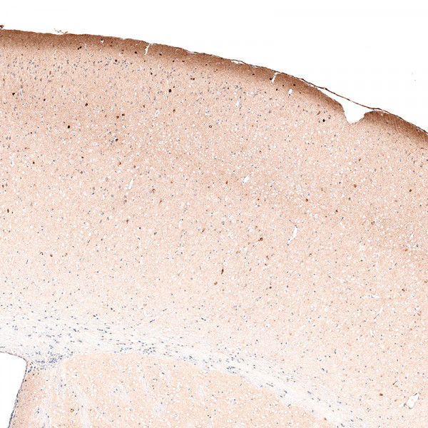 Anti-RELN, clone CL5324