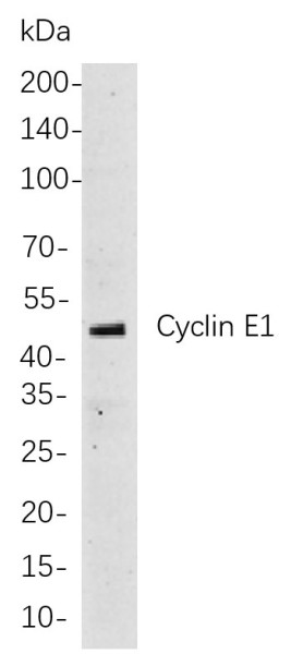 Anti-Recombinant Cyclin E1, clone 6G15