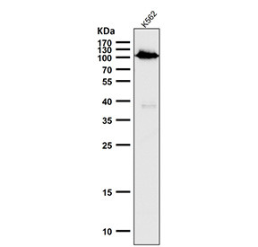 Anti-phospho-Rb (Ser780) / Retinoblastoma, clone 31R44