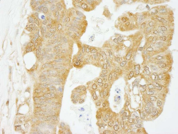 Anti-eIF4G1/eIF4GI (IHC)