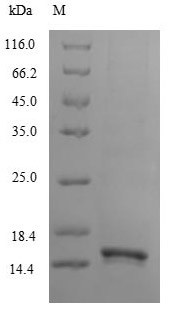Lymphocyte antigen 6 complex locus protein G6d (LY6G6D), partial, human, recombinant