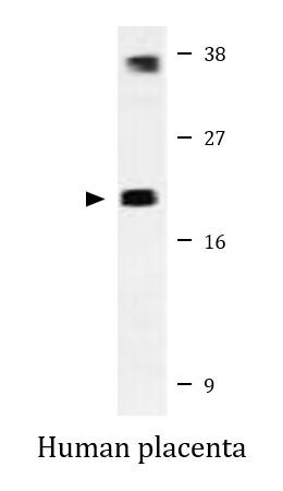 Anti-MYL12B