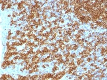 Anti-CD45RA (Leukocyte marker), clone PTPRC/1148
