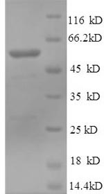 Muscle, skeletal receptor tyrosine-protein kinase (MUSK),partial, human, recombinant