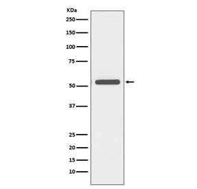 Anti-Keratin 6 / Cytokeratin 6, clone GAO-11