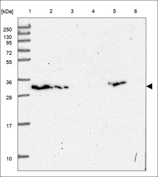 Anti-CNOT7