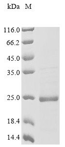 Midkine (RIHB), chicken, recombinant