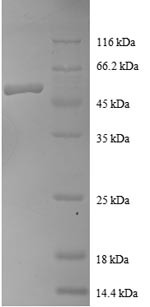 Ras-related protein Rab-1A (RAB1A), human, recombinant