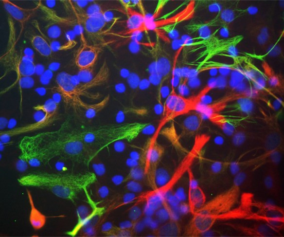 Anti-Nestin, clone 4D11