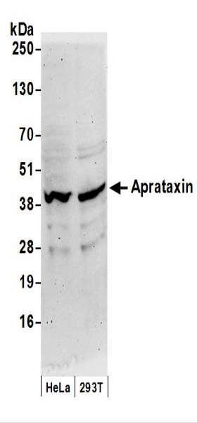 Anti-Aprataxin