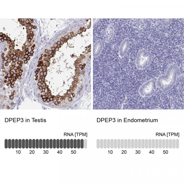 Anti-DPEP3