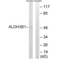 Anti-ALDH3B1