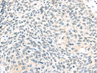 Anti-TCEB1