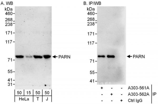 Anti-PARN