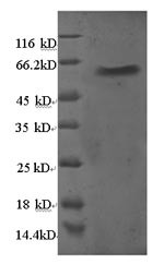 60S ribosomal protein L5 (RPL5), human, recombinant