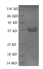 50S ribosomal protein L28 (rpmB), Escherichia coli, recombinant