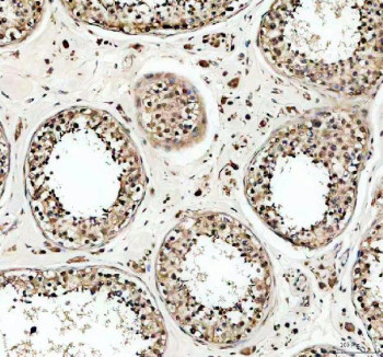 Anti-USP5 / Ubiquitin carboxyl-terminal hydrolase 5