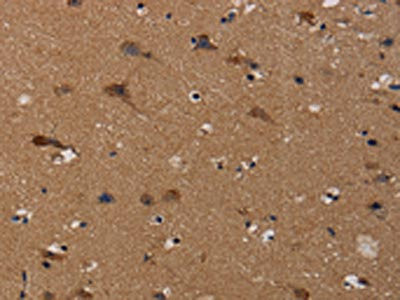Anti-TP53INP1