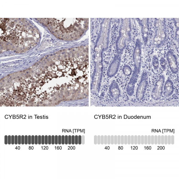 Anti-CYB5R2
