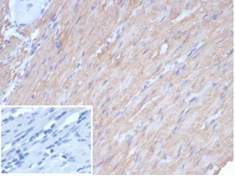 Anti-Caldesmon, HMW (h-Caldesmon) (Smooth Muscle Marker), recombinant antibody, clone rCALD1/7266